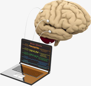 About Neurofeedback About Neurofeedback